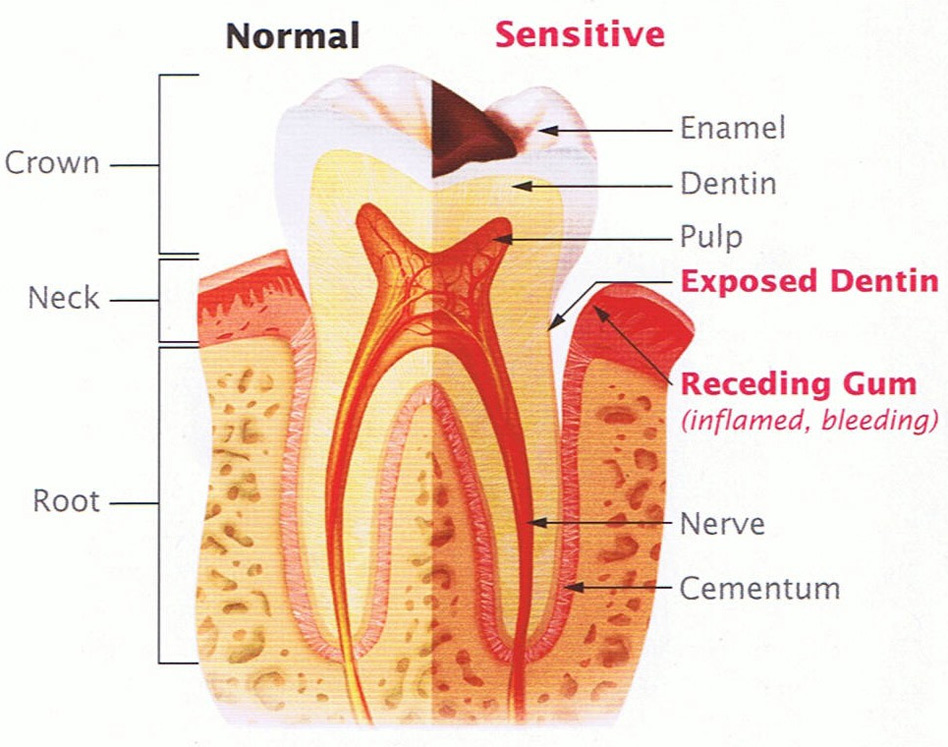 Content image for Dental Care for Sensitive Teeth: Finding Relief from Painful Hot and Cold