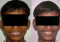 Featured image for The Challenge of Affordable Orthodontic Care: Straightening Teeth Without Breaking the Bank