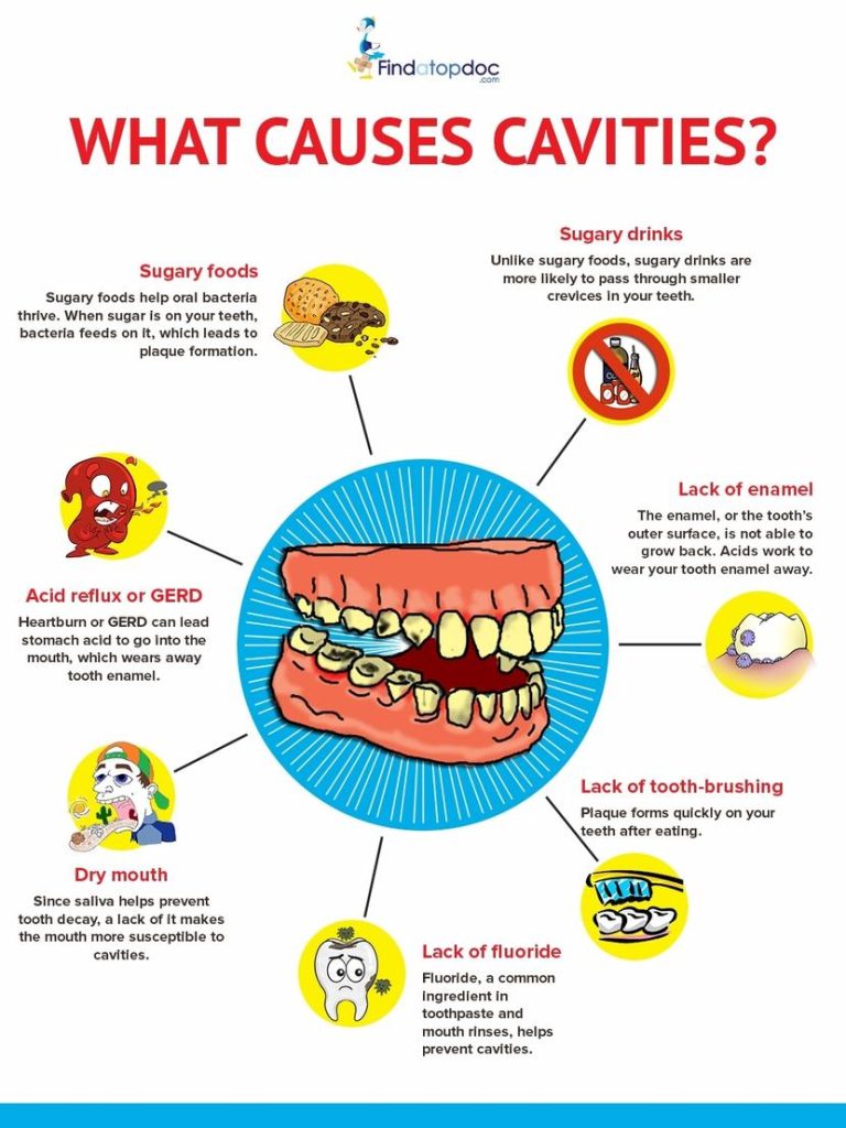 Content image for The Mystery of Tooth Decay: Why Do I Still Get Cavities with Good Dental Care?