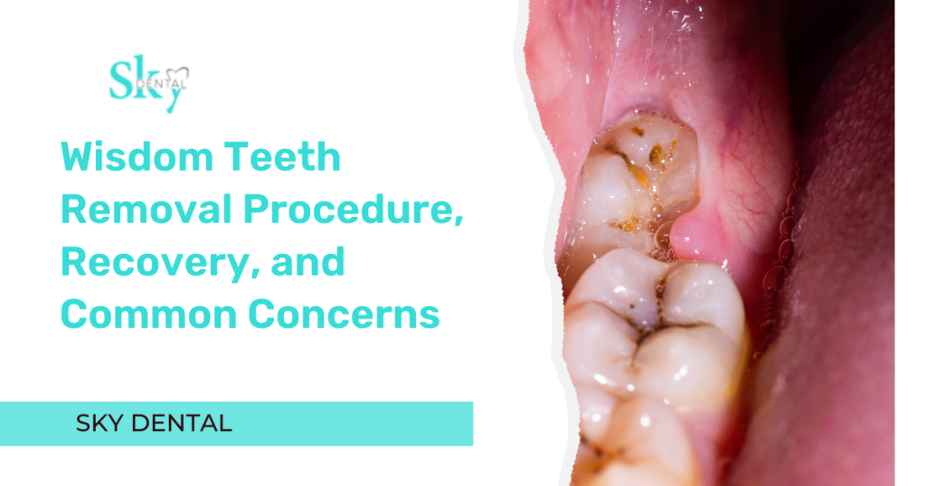 Content image for The Anxiety of Wisdom Teeth Removal: Understanding the Procedure and Recovery