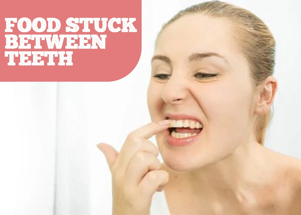 Content image for The Frustration of Food Getting Stuck in Teeth Despite Flossing