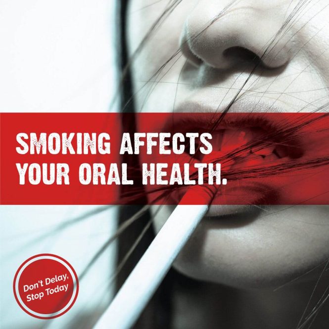 Featured image for Dental Care for Smokers: Understanding the Increased Risks to Oral Health
