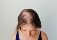 Featured image for Hair Loss Frustration: Why Am I Losing More Hair Than Ever Before?