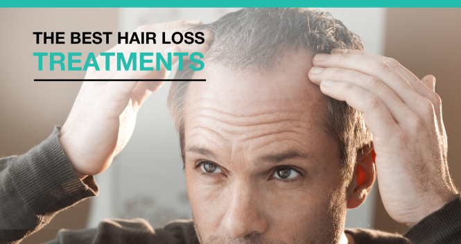 Featured image for Budgeting for Hair Loss Solutions: Affordable Treatments and Options