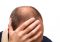 Featured image for Hair Loss Anxiety: Coping with the Emotional Impact of Thinning Hair