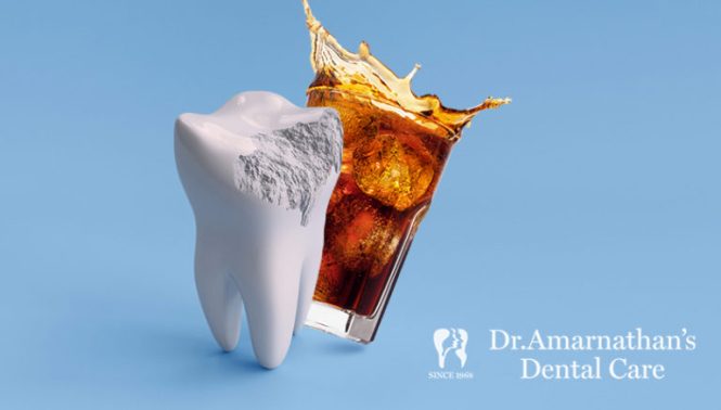 Featured image for Dental Care for Tooth Erosion: Protecting Enamel from Acidic Foods and Drinks
