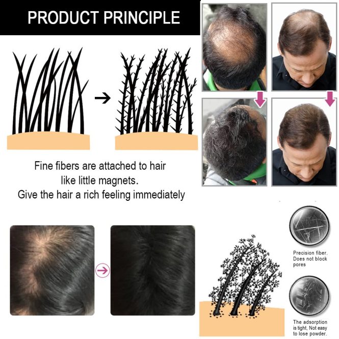 Featured image for Hair Loss and Self-Esteem: Rebuilding Confidence with Thinning Hair