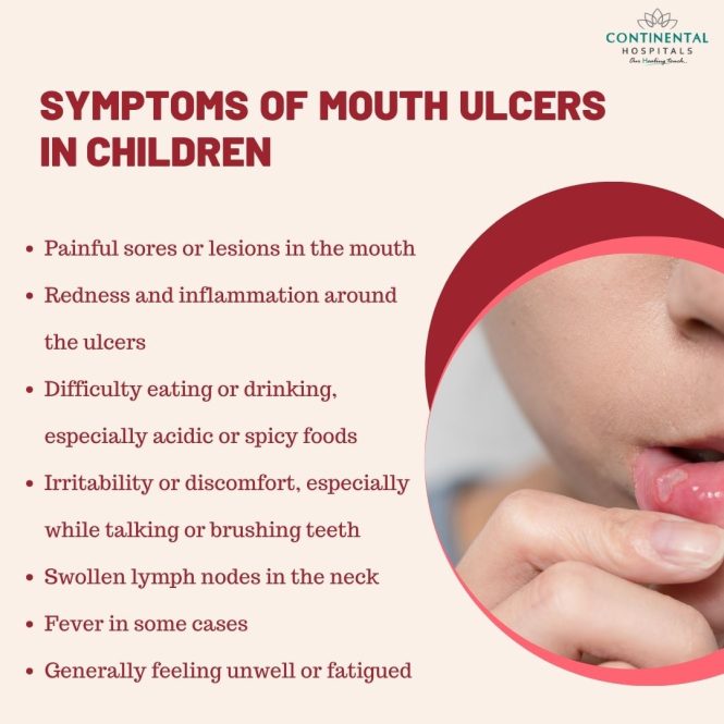 Featured image for The Discomfort of Mouth Sores and Ulcers: Finding Relief and Understanding Causes