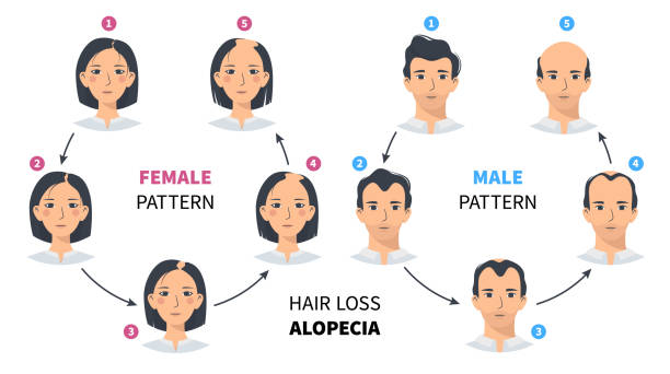 Content image for Hair Loss in Women: Understanding the Unique Causes and Treatments