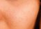 Featured image for Taming the Oil Slick: Effective Skin Care Strategies for Excess Sebum Control