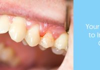 Featured image for The Discomfort of Swollen Gums and Potential Underlying Issues