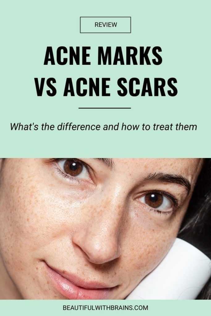 Content image for Fading the Evidence: Effective Skin Care for Post-Acne Marks and Scars