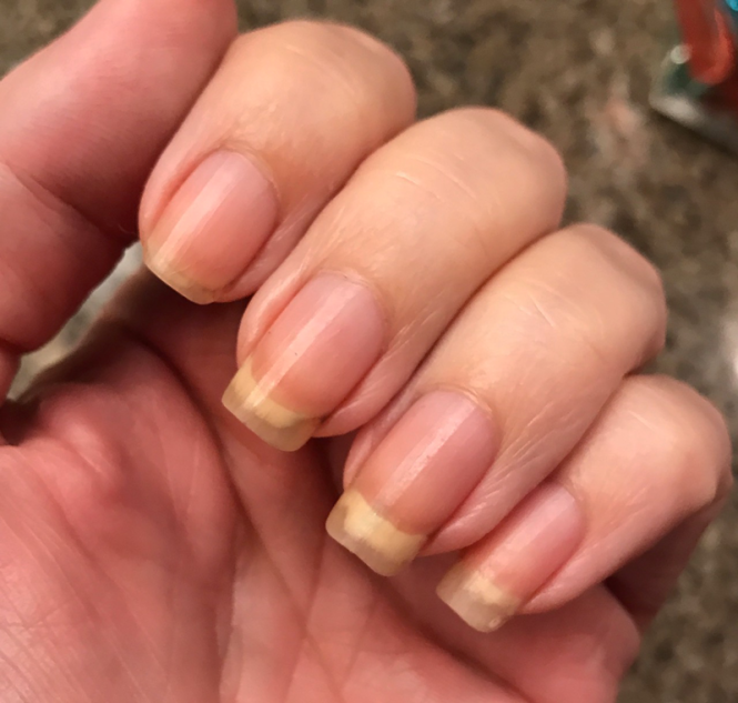 Featured image for SOS for Severely Dry Skin: Intensive Hydration Techniques That Work