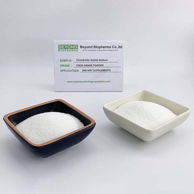 Featured image for Supplementing for Joint Health: Beyond Glucosamine and Chondroitin