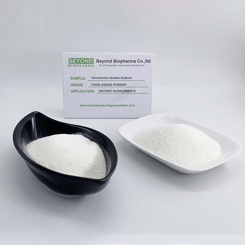 Content image for Supplementing for Joint Health: Beyond Glucosamine and Chondroitin