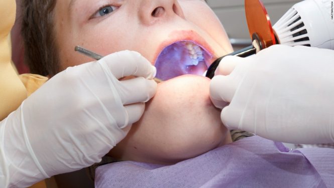 Featured image for The Frustration of Supplements That Stain Your Teeth or Upset Your Stomach